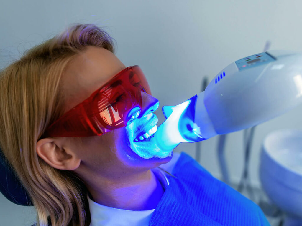 5 Teeth Whitening Treatments: The Ultimate Smile Solution Guide